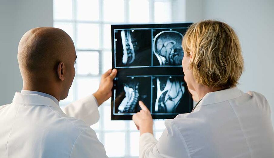 diagnostika cervikální osteochondrózy obrázky