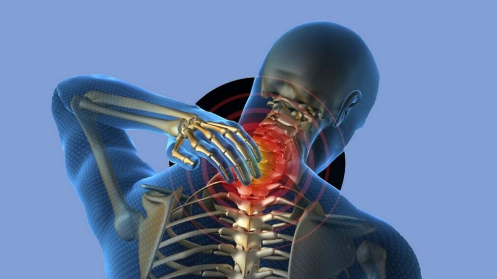 Osteochondrosis v oblasti děložního čípku