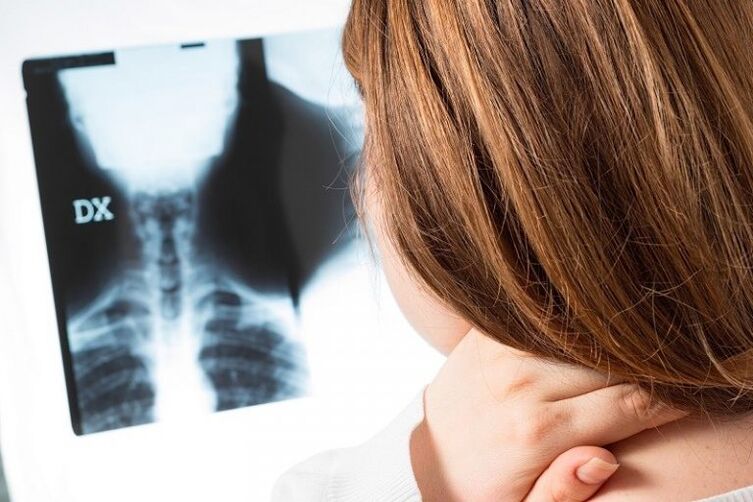 X -ray z oblasti děložního čípku
