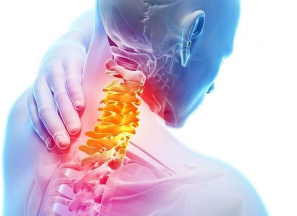 Osteochondroza krční páteře
