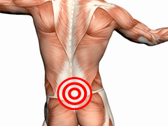 Příznaky a léčba bederní osteochondrosis