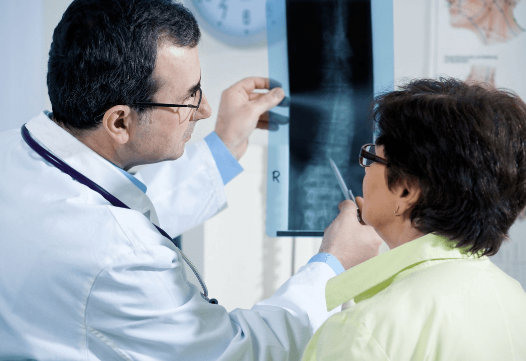 Neurolog diagnostikuje osteochondrózu pomocí radiografie páteře
