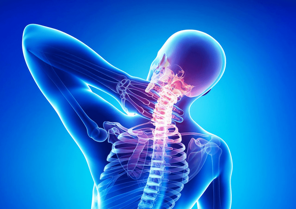 Osteochondróza páteře