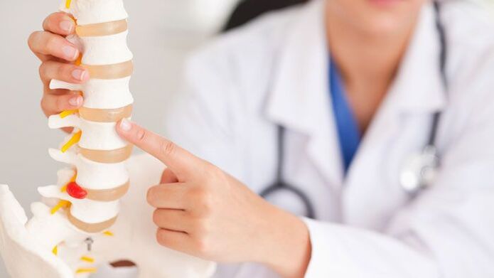 vysvětlení bederní osteochondrózy na modelu páteře